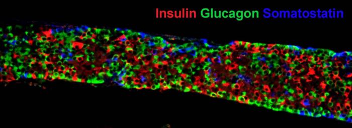 лечения сахарного диабета 2-го типа стволовыми клетками