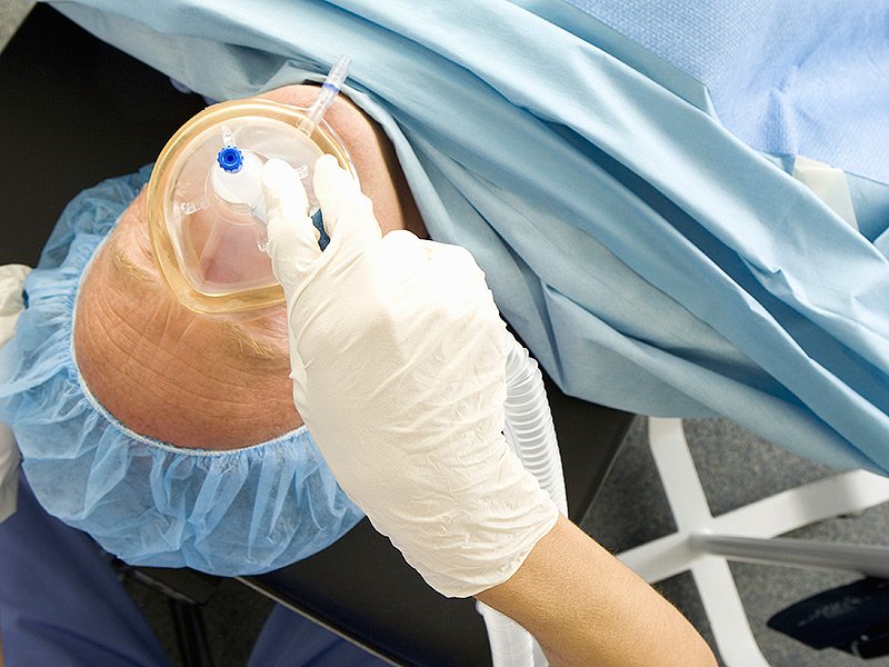 Общая анестезия может свести на нет преимущества эндоваскулярного лечения инсульта