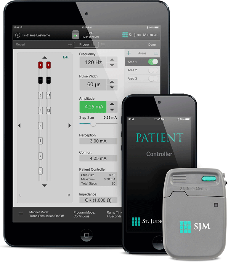  Система Invisible Trial System компании St. Jude Medical использует iPad и iPod для управления обезболивающего нейростимулятора 