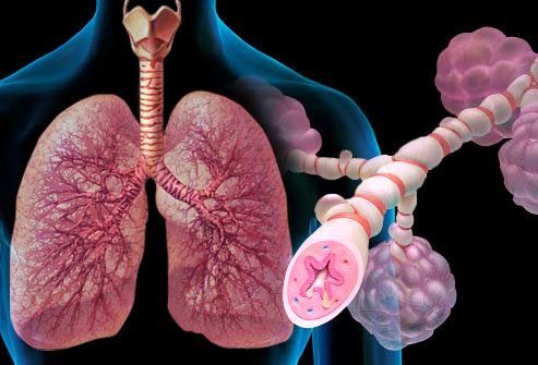 Бронхиальная астма в картинках