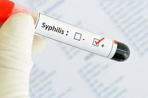 Диагностика сифилиса