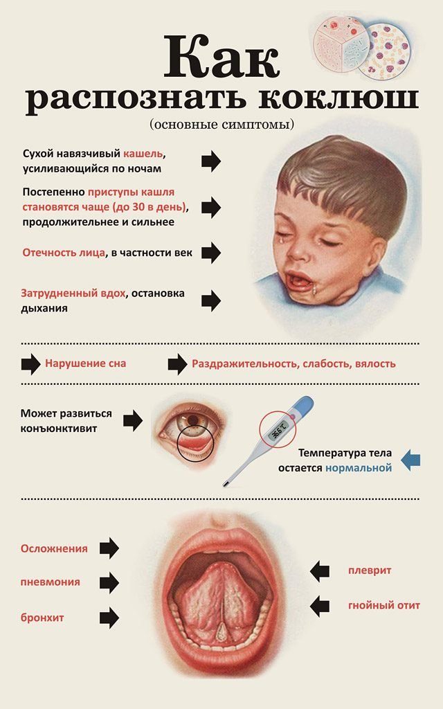 Коклюш карта вызова