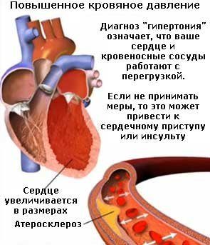 Важность постоянного контроля артериального давления