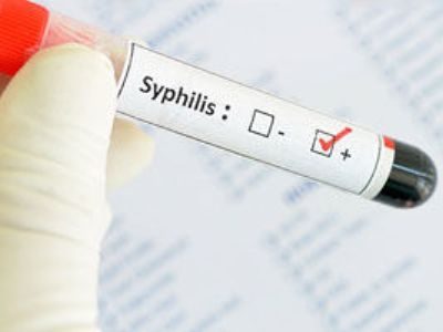 Анализ крови на сифилис