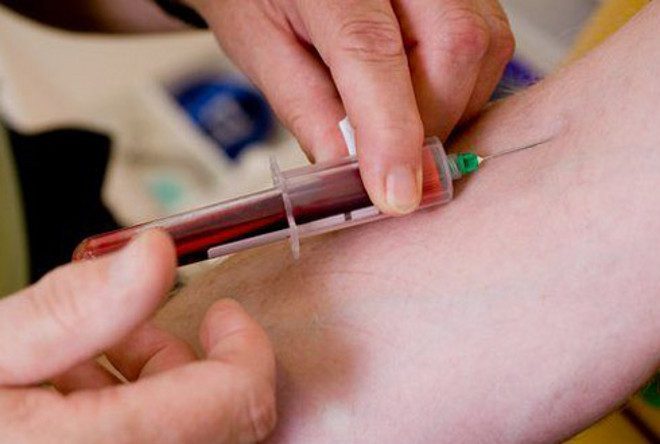 Анализы крови на маркеры вирусных гепатитов