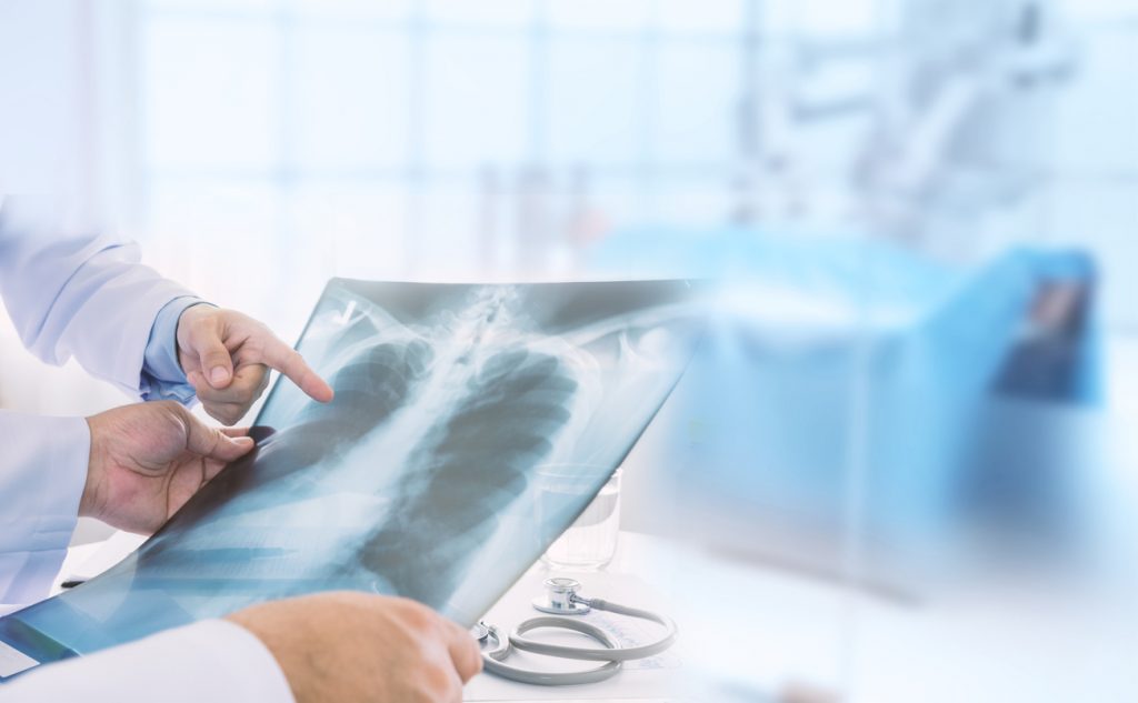 Рентген легких: подготовка, техника, значение, как читать, проблемы на снимках