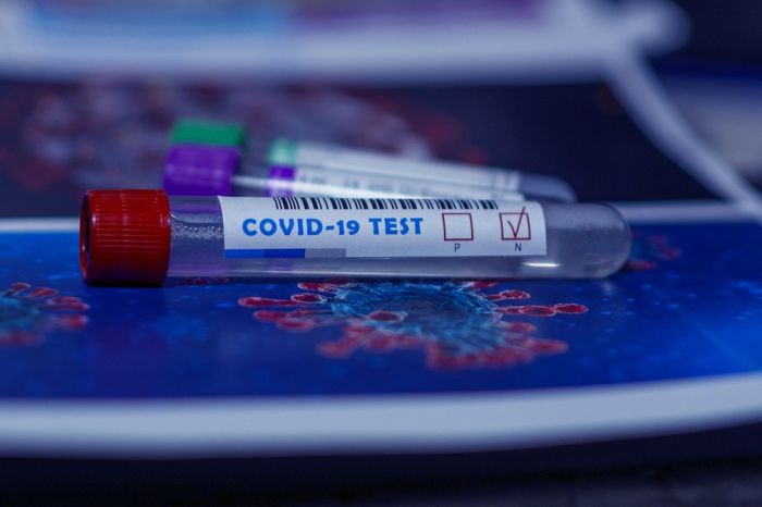 Американская академия педиатрии рассказала об оптимальных сроках тестирования детей на COVID-19